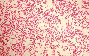 Bacteroides vulgatus / Phocaeicola vulgatus Gram stain