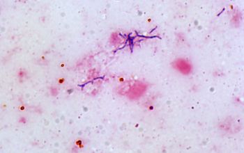 Bifidobacterium species Gram stain