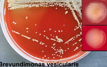 Brevundimonas vesicularis Blood Agar 48h culture incubated with O2