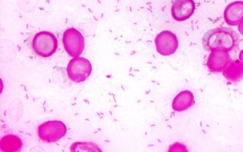 Campylobacter coli Gram stain