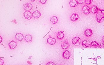 Campylobacter fetus Gram stain