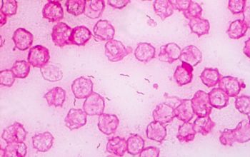 Campylobacter fetus Gram stain