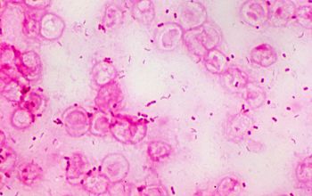Campylobacter jejuni Gram stain