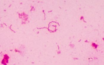 Campylobacter lari Gram stain
