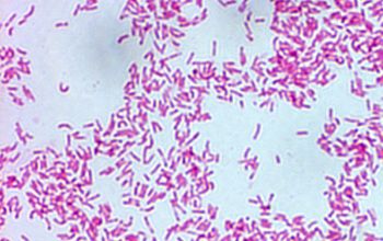 Campylobacter ureolyticus Gram stain