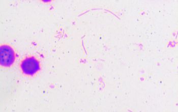 Capnocytophaga canimorsus Gram stain