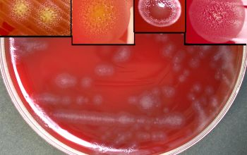 Capnocytophaga gingivalis Blood Agar 48h culture incubated with CO2