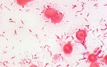 Capnocytophaga sputigena Gram stain
