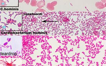 Cardiobacterium hominis Gram stain