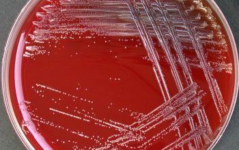 Cardiobacterium hominis Blood Agar 48h culture incubated with CO2
