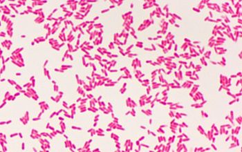 Cardiobacterium hominis