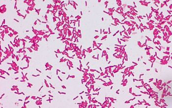 Chromobacterium violaceum Gram stain