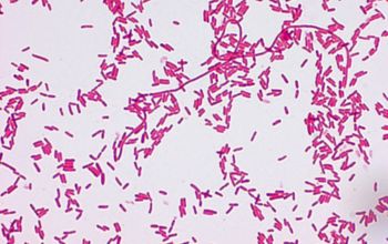 Chromobacterium violaceum Gram stain