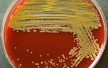 Chryseobacterium indologenes Blood Agar 24h culture incubated with CO2