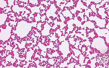 Chryseobacterium indologenes Gram stain