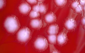 Clostridium bifermentans Brucella Blood Agar 48h culture 