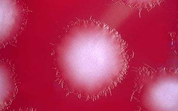 Clostridium bifermentans Brucella Blood Agar 48h culture anaerobicly incubated