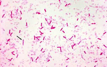 Clostridium botulinum Gram stain