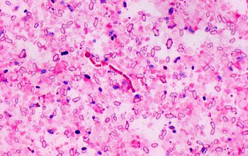 Clostridium butyricum Gram stain