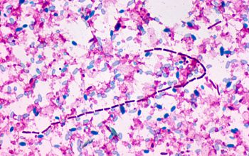 Clostridium butyricum Wirtz stain