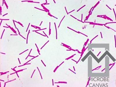 Clostridium Difficile Gram Stain