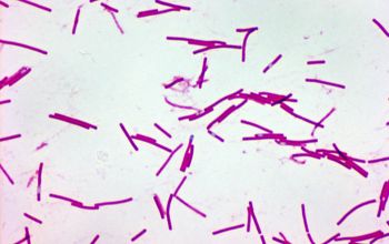 Clostridium difficile Wirtz stain