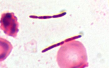 Clostridium hatewayi 