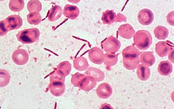 Clostridium hatewayi Gram stain