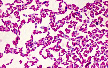 Clostridium histolyticum Gram stain