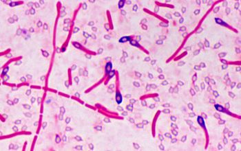 Clostridium limosum Gram stain