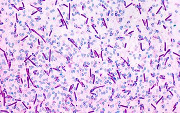 Clostridium limosum Wirtz stain
