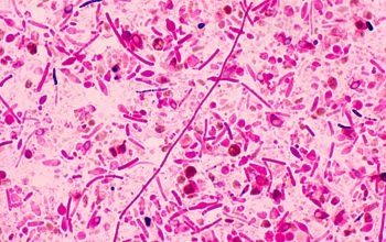 Clostridium novyi type A Gram stain