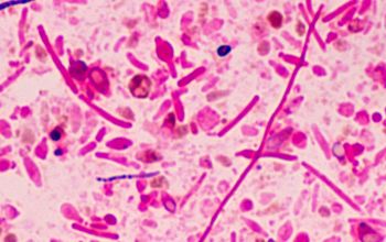 Clostridium novyi type A Gram stain