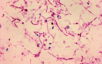 Clostridium novyi type A Wirtz stain
