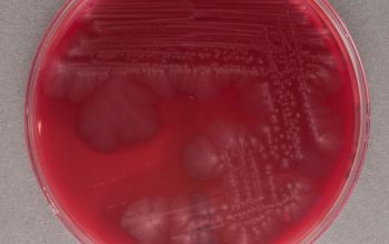 Clostridium perfringens Brucella Blood Agar 48h culture anaerobicly incubated