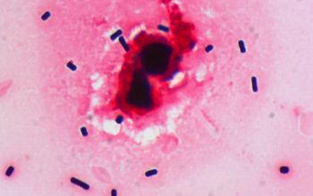 Clostridium perfringens Gram stain