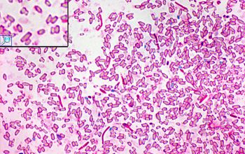 Clostridium septicum Wirtz stain