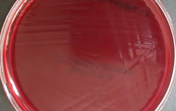 Clostridium septicum Brucella Blood Agar 24h culture anaerobicly incubated
