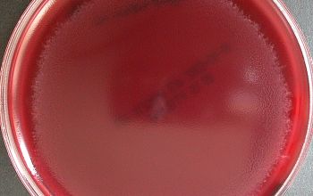 Clostridium septicum Brucella Blood Agar 24h culture anaerobicly incubated