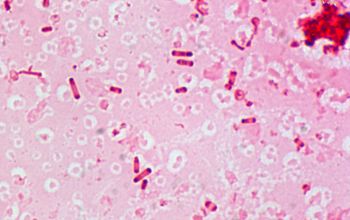 Clostridium septicum Gram stain