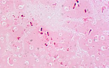 Clostridium septicum Gram stain