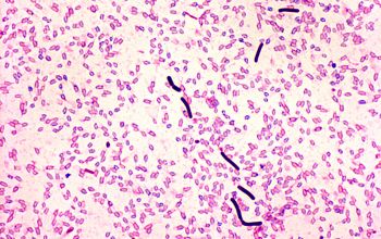 Clostridium sordellii Gram stain