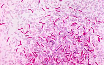 Clostridium sordellii Wirtz stain