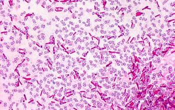 Clostridium sporogenes Wirtz stain