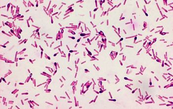 Clostridium sporogenes Gram stain