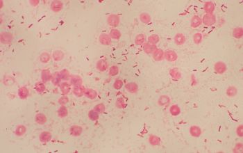 Clostridium tertium Gram stain