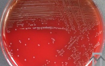 Clostridium tertium Blood Agar 48h culture incubated with CO2