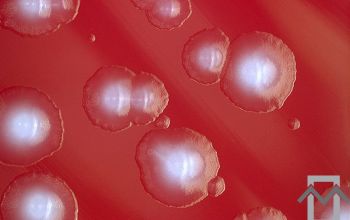 Clostridium tertium Blood Agar 24h culture anaerobicly incubated