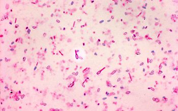 Clostridium tertium Wirtz stain