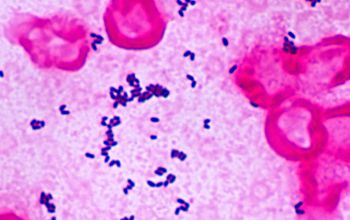 corynebacterium gram stain